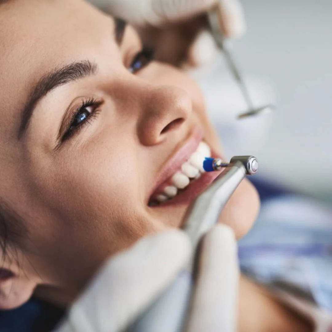 Limpieza Dental con Pulido + Evaluación Odontológica + Uso de Cámara Intraoral por $14 en Clínica Dental Pacific Bay - Image 3